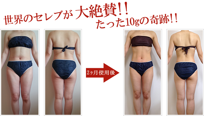 痩身業界に革命 痩身クリームで激痩せ